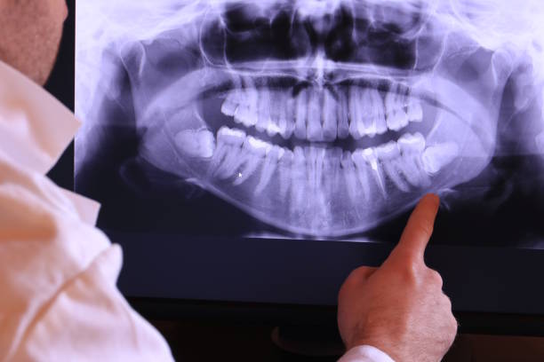 Best Pediatric Emergency Dentist in Barnesville, OH