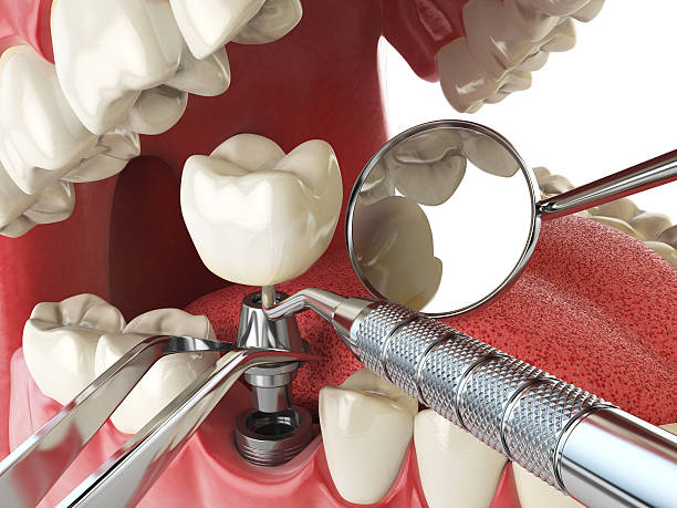 Best Walk-In Emergency Dentist in Barnesville, OH